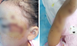 阆中城管执法起冲突误伤女童 城管局回应